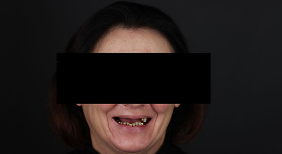 Фото пациента до лечения