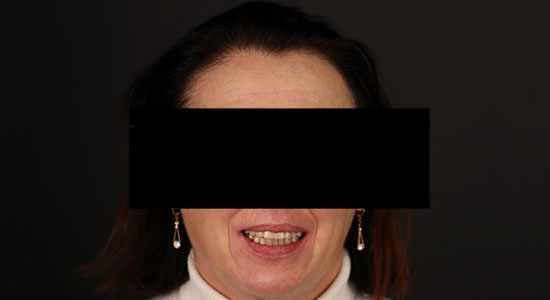 Фото пациента после лечения